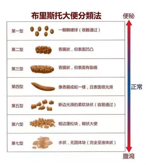 拉很多屎|几天一次大便是正常的？大便频率不是最重要的，关键是这三个指。